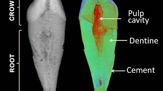 MicroCT study of a human canine tooth high definition [upl. by Man]