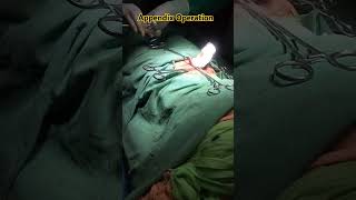 Appendix operation medical ms doctorlife shorts [upl. by Werdma]