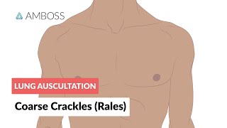 Coarse Crackles Rales  Lung Auscultation  Episode 3 [upl. by Llenrac]