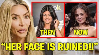 Kim Kardashian EXPOSES Kylie Jenner’s BOTCHED Plastic Surgery [upl. by Barbra]