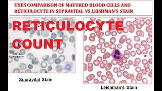 Reticulocyte Count  Supravital stain Comparison of Reticulocyte and Mature Red Blood Cell RBC [upl. by Gail344]