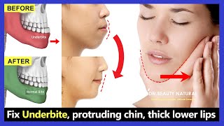 5 Exercises Fix Underbite without surgery fix protruding chin reduce thick lower lip [upl. by Xavier]